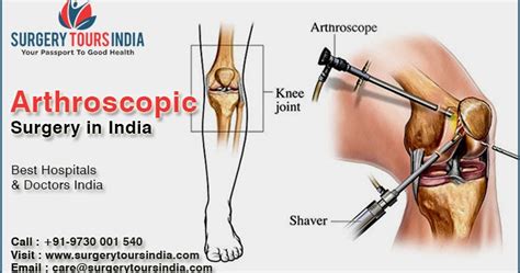 Arthroscopic Surgery In India Cost Arthroscopy Surgery India