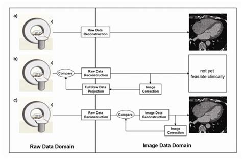 Comparison Of Different Reconstruction Algorithms Various Image