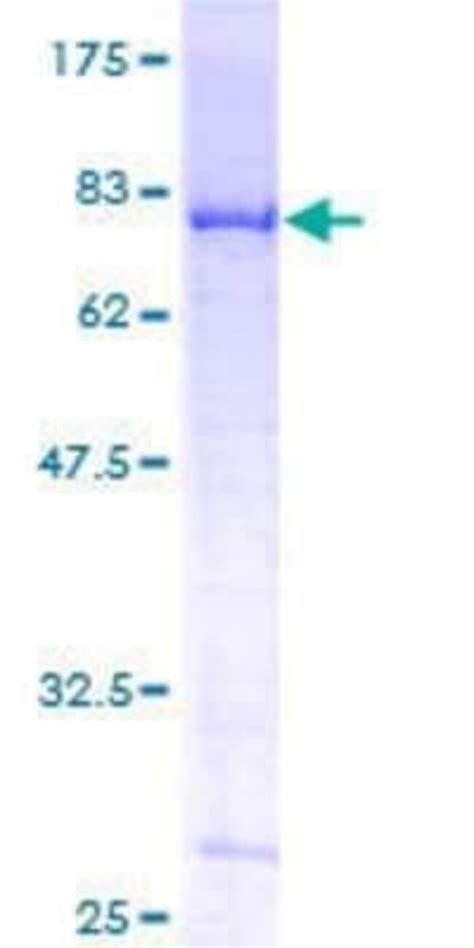 Novus Biologicals Recombinant Human DDX6 GST N Term Protein 10 μg