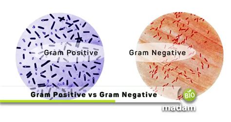 Difference Between Gram Positive And Gram Negative Bacteria Biomadam