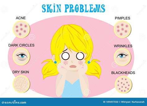 Common Skin Diseases Vector Illustration | CartoonDealer.com #42749056