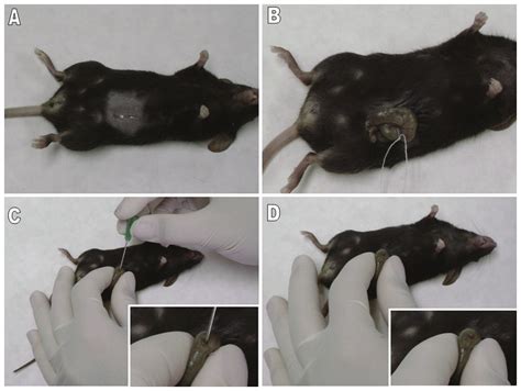 Cecal Ligation And Puncture Procedures Mice Were Anesthetized And The