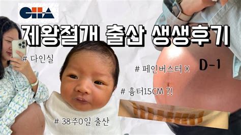 제왕절개 출산 브이로그 시험관 아기 제왕절개 흉터 제왕절개 운동 강남차병원 다인실 Youtube