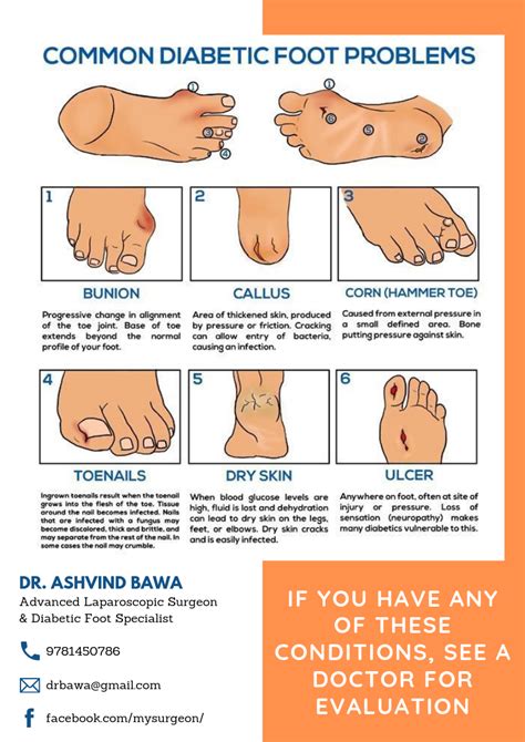 Common Diabetic Foot Problem Pathologie Anatomie