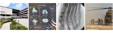 Chirurgie Orthopédique et traumatologie Hôpital national d