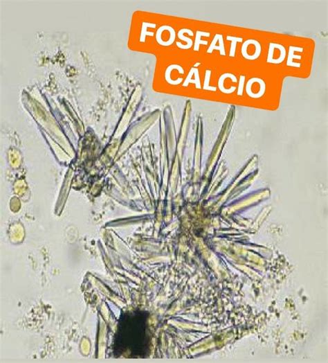 Cristais De Fosfato De C Lcio Detalhes E Caracter Sticas