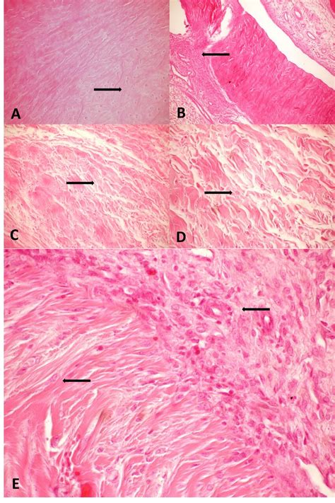 Microscopic View Of The Tissues Obtained From Rabbits In The Rt And