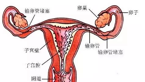 输卵管粘连还能自然受孕吗？