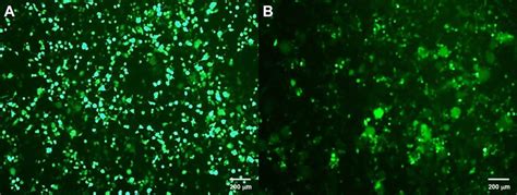 Gfp Expression In Cells At 48 H Post Transduction With The 2nd And 3rd