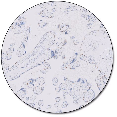 Pd L Ihc C Pharmdx For Use With Dako Omnis Agilent Off