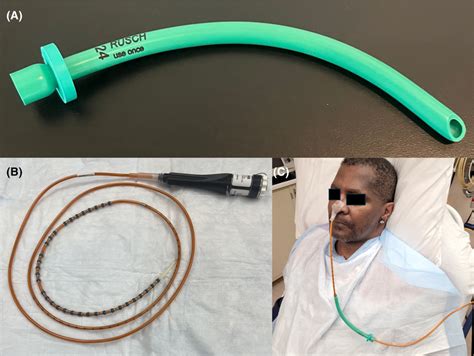 Highresolution Esophageal Manometry HREM Catheter Placement Via A