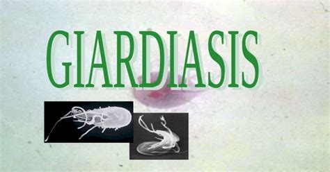 Giardiasis Agente Etiologico Giardia Lambliag Intestinalis G Duodenalis Estado Infectante