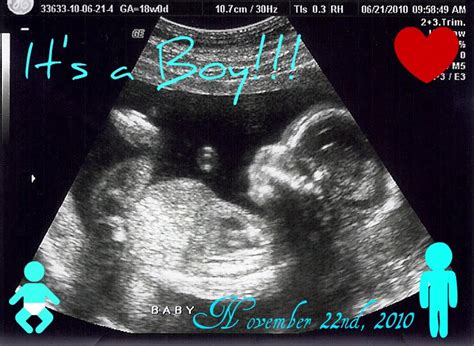 It's A Boy! Beca and Jesse's Baby: Ultrasound June 21st, 2010