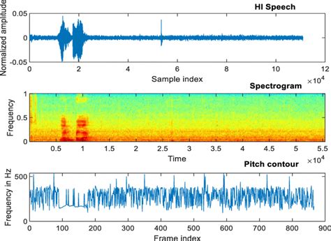 Hi Speech Male Signal Spectrogram And Pitch Frequency Contour