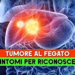 Tumore Al Fegato I Sintomi Per Riconoscerlo From Guida Al Benessere