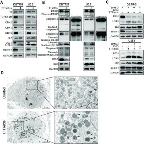 Ttfields Induced Cell Apoptosis And Suppressed Autophagic Flux In Gbm