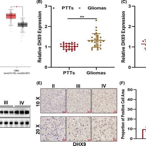 DHX9 Knockdown Suppressed Glioma Growth And Macrophage Infiltration In