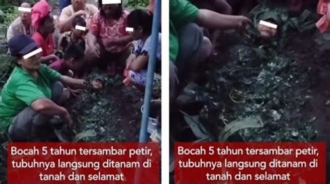 Bukan Sulap Bukan Sihir Bocah Tersambar Petir Di Sumut Disebut Selamat