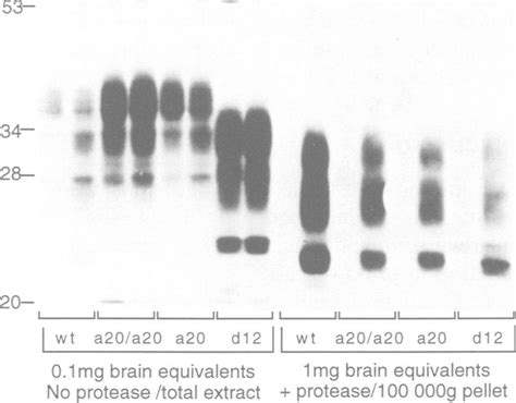 Western Blot Analysis For Total Prp And Prps In Brains Of Mice