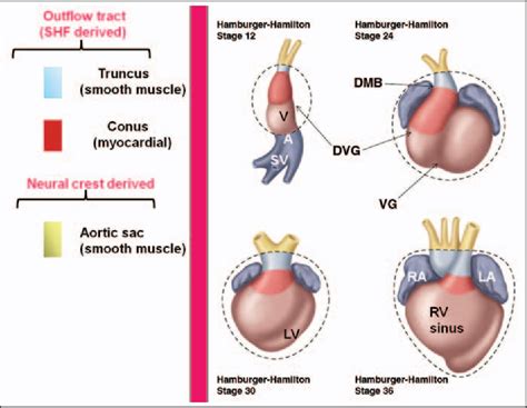 Figure 6 from Right ventricular outflow tract imaging with CT and MRI ...