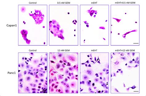 Hematoxylin Eosin Staining 48 H Post Treatment The Formalin Fixed Download Scientific