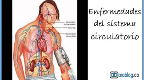 Enfermedades Que Afectan Al Aparato Circulatorio Dinami