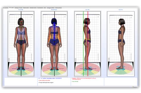 Cartella Clinica Valutazione Posturale