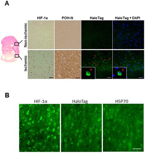 A Immunohistochemical analysis of HIF 1α POH N ODD and HaloTag