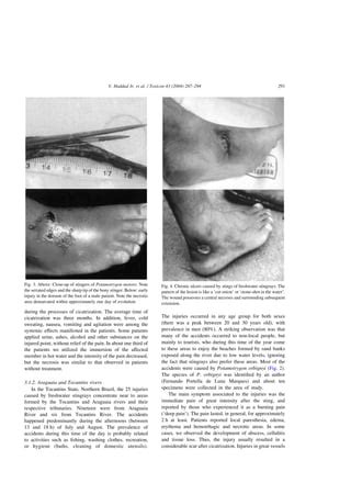 Haddad Et Al Freshwater Stingrays Study Of Epidemiologic