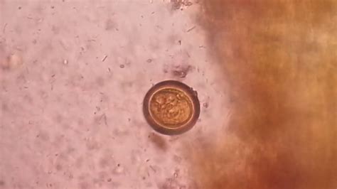 Egg Of Tapeworm Or Taenia Under The Microscope Of Saline Preparation Youtube