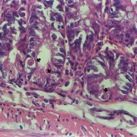 Photomicrograph Of H E Stained Sections Of The Small Intestinal Crypt