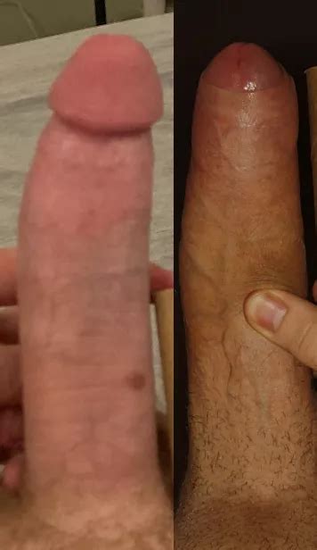 Met My Match You Prefer Cut Or Uncut Bwc Nudes Cockcompare Nude