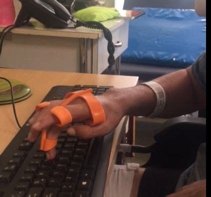 Orthosis For Typing And Touchscreen By GabrielaB Thingiverse