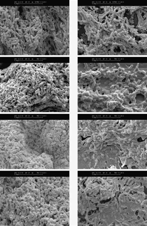 Sem Photomicrographs Of Day Old Biofilms Formed Under Turbulent A