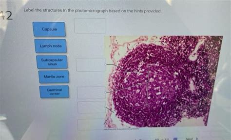 Solved Label The Structures In The Photomicrograph Based On Chegg