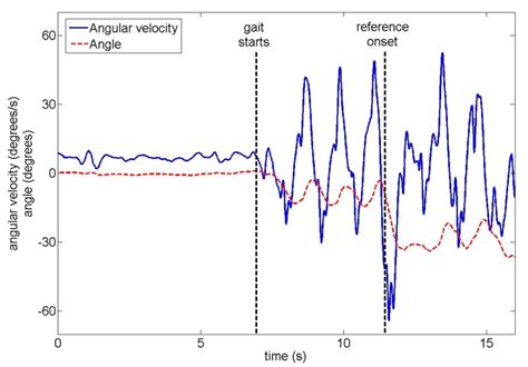 Sensors | Special Issue : Biomedical Sensors and Systems