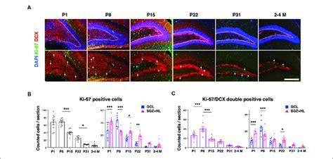 The Expression Of Ki 67 And Dcx In The Dg A Representative Download Scientific Diagram