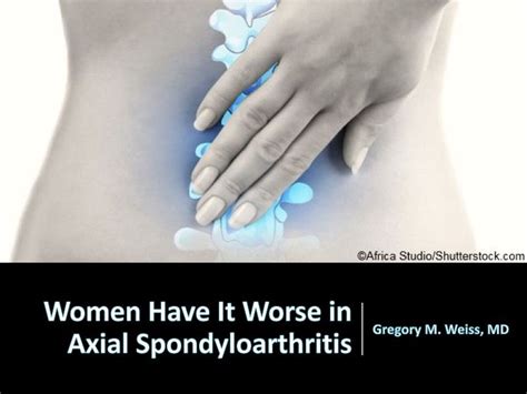 Women Have It Worse In Axial Spondyloarthritis Rheumatology Network