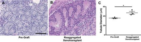 Increased Tubular Diameter In Re Aggregated Fetal Rat Testis