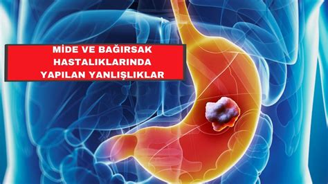 MİDE VE BAĞIRSAK HASTALIKLARINDA YAPILAN YANLIŞLAR YouTube