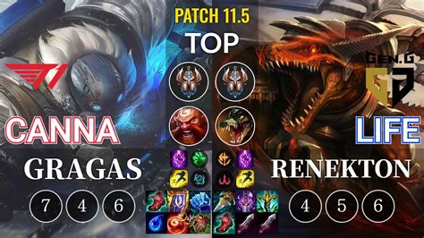 T Canna Gragas Vs Gen Life Renekton Top Kr Patch Youtube