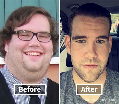 50+ Amazing Before & After Pics Reveal How Weight Loss Affects Your ...