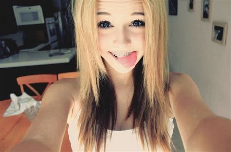 These Girls With Braces Are Just Far Too Adorable