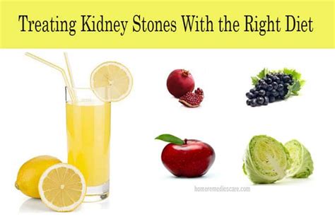 Treating Kidney Stones with the Right Diet