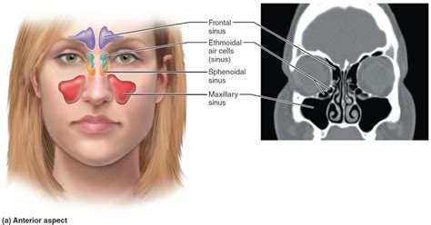 Allergic Fungal Sinusitis Causes Symptoms And Treatment