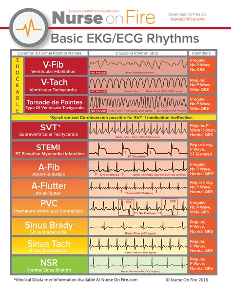 Ekg rhythms – Artofit