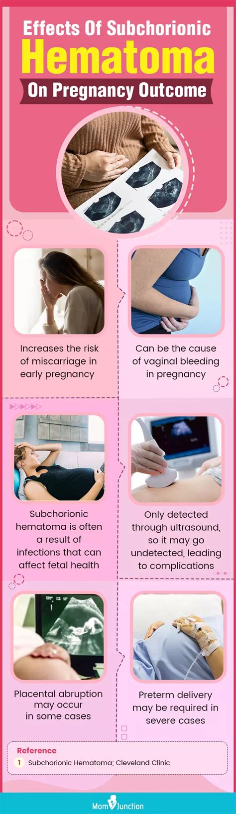 Subchorionic Hematoma What It Is Causes And Pregnancy Risk