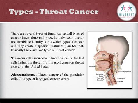 Ppt What Is Throat Cancer And It’s Awareness University Cancer Centers Powerpoint