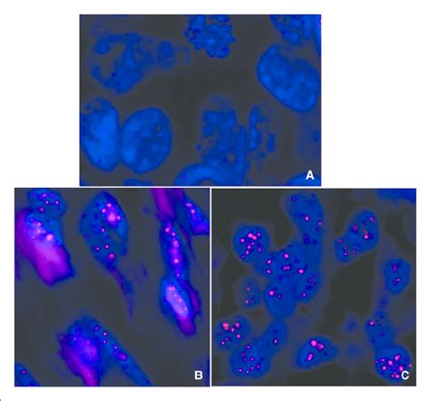 Representative Pictures Of Telomere Fluorescence In Situ Hybridization