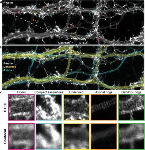 Sted Nanoscopy Reveals Diverse Nanostructures Of F Actin In Cultured